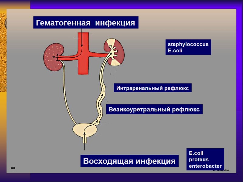 Гематогенная  инфекция Интраренальный рефлюкс Везикоуретральный рефлюкс Восходящая инфекция E.coli proteus enterobacter staphylococcus E.coli